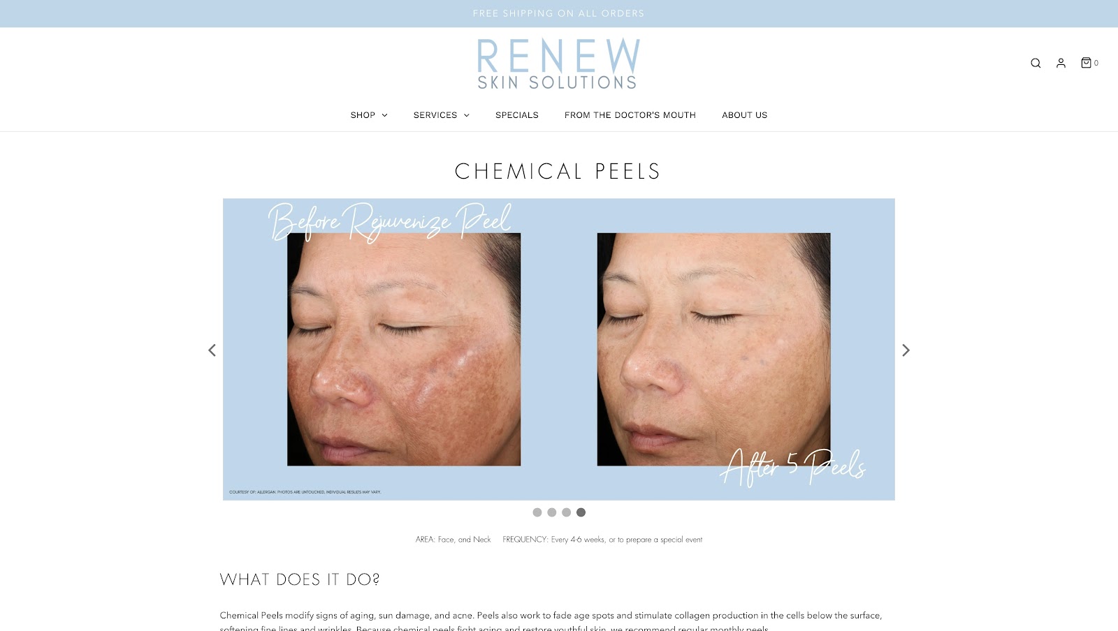 renew skin solutions chemical peel page